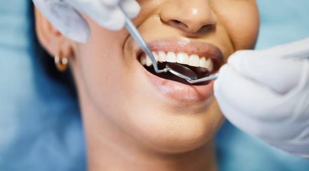 Best Chipped Tooth Repair Near Me  in Lindsay, TX